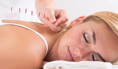 Controversial Acupuncture topics